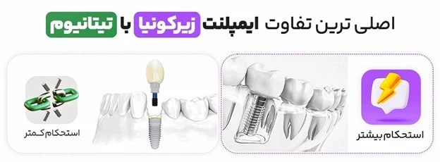 ایمپلنت حساسیت به ایمپلنت تیتانیوم + دلایل و راه تشخیص