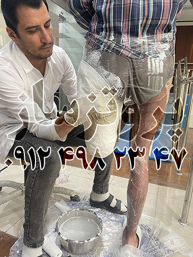 مرکز ساخت پروتز