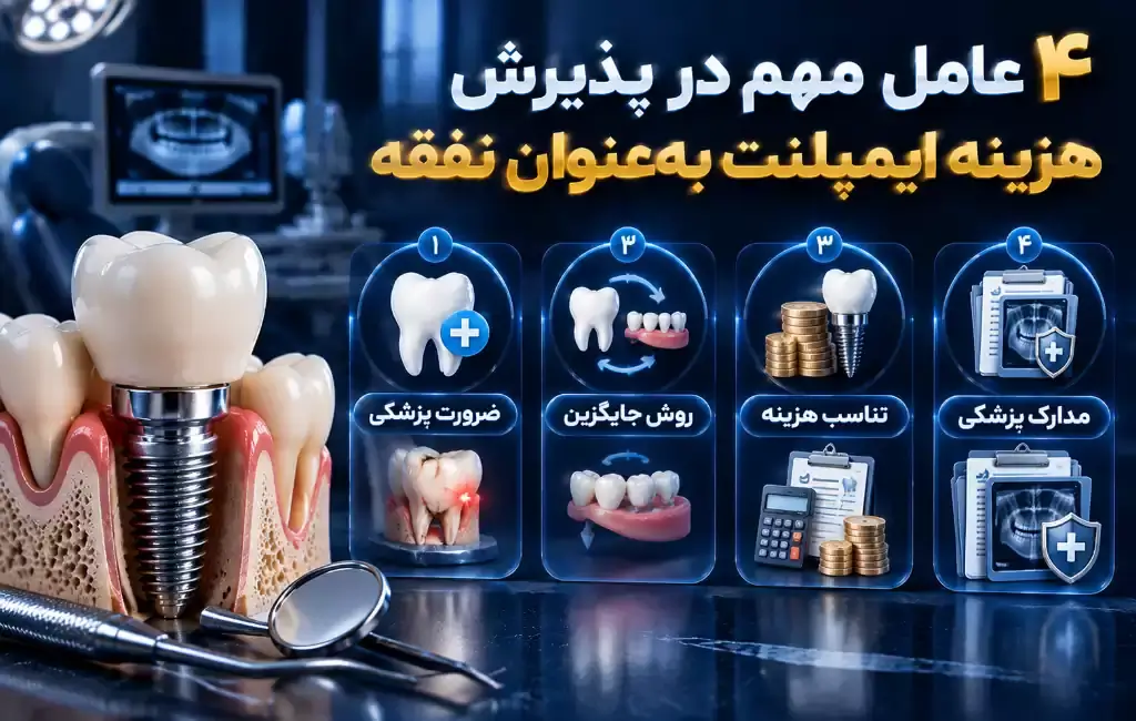 عوامل مهم در پذیرش هزینه ایمپلنت بعنوان نفقه