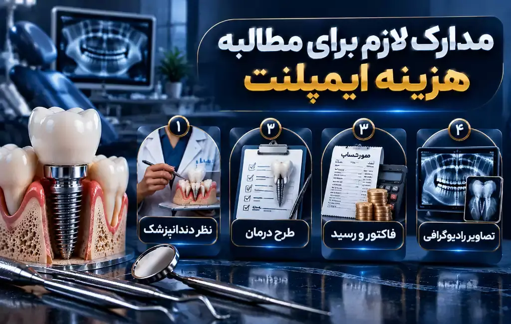مدارک لازم برای مطالبه هزینه ایمپلنت