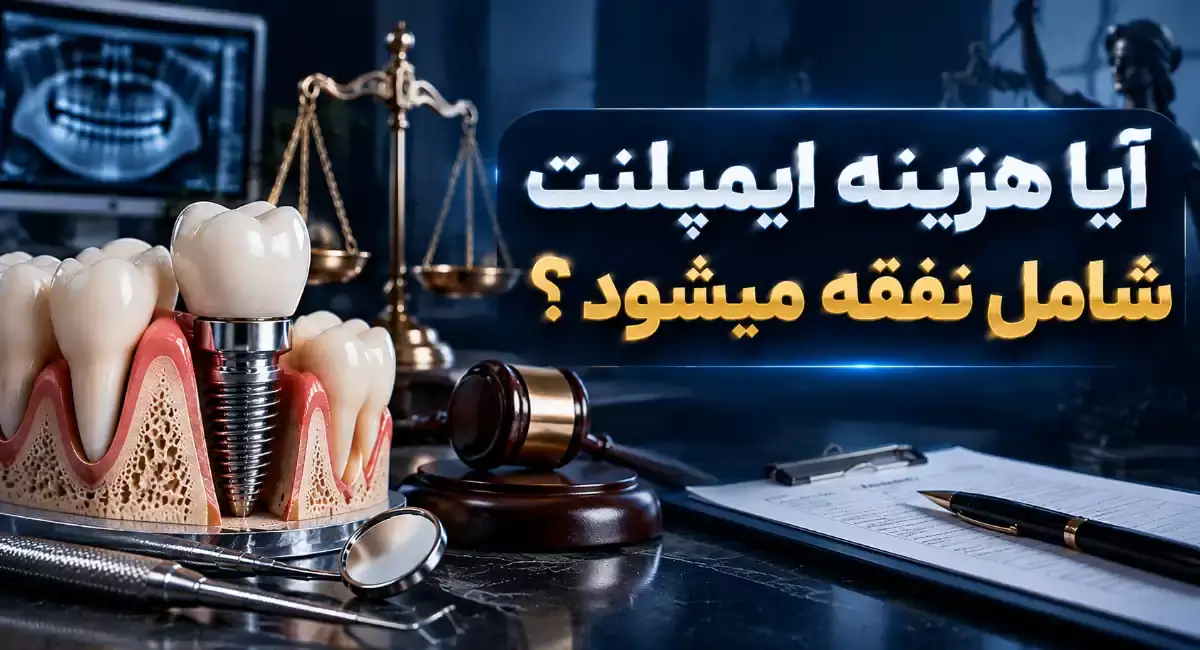 آیا هزینه ایمپلنت شامل نفقه می شود؟ بررسی قانون و وظیفه شوهر